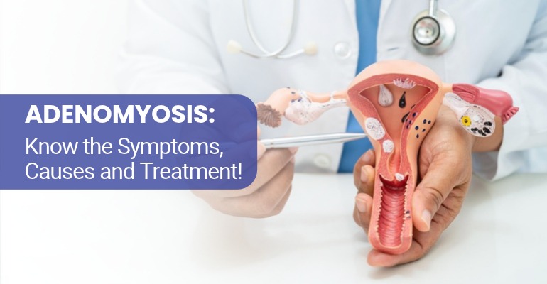 Adenomyosis: Causes, Symptoms, Diagnosis, Treatment and Precautions