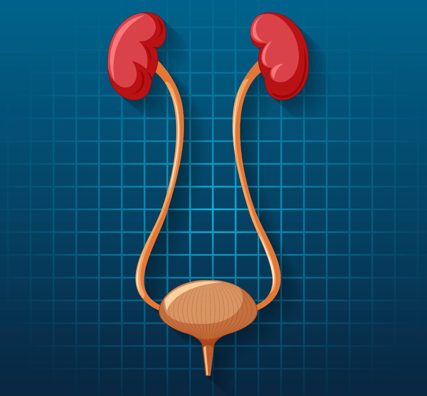 DJ Stent: Purpose, Symptoms, Recovery and When It Should Be Removed