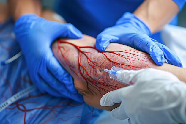 Best Vascular & Endovascular Hospital in Hyderabad